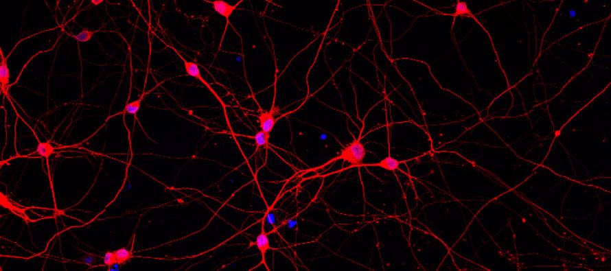 Una proteína que en exceso termina asociada a enfermedades neurodegenerativas