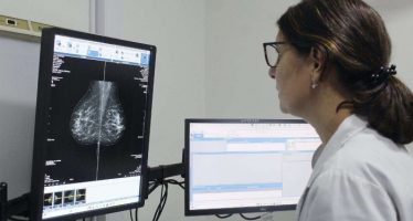 La Provincia comenzará a indicar la mamografía a los 40 años