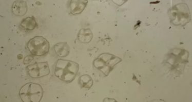 Alerta ambiental en Bariloche: detectan medusas invasoras en los lagos Escondido y El Trébol